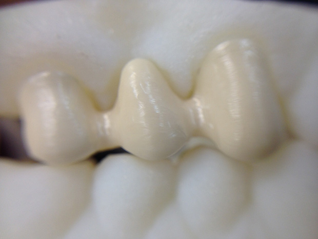 Fitting of a zirconium frame on a control model-2