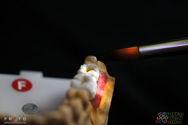 Crowns under construction