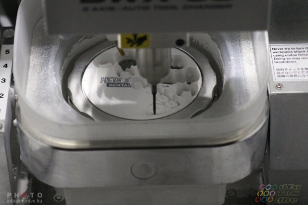 Design and implementation of CAD/CAM crown-4