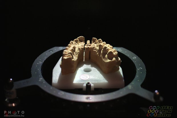 Design and implementation of CAD/CAM crown