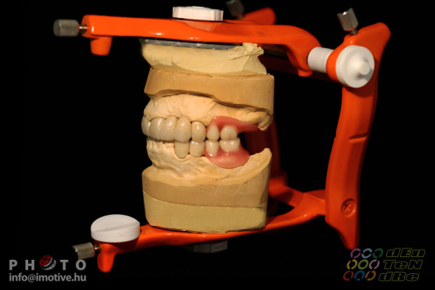 Combined solution with ball attachment.-5