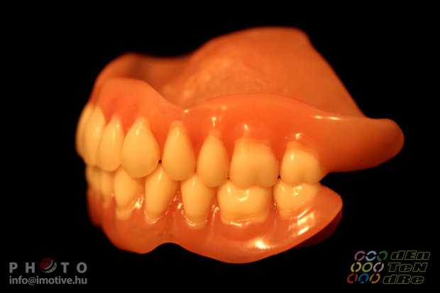 Upper and lower full dentures-2
