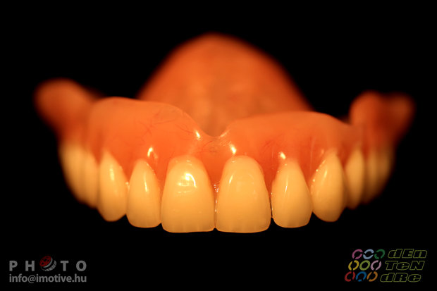 Upper and lower full dentures-3