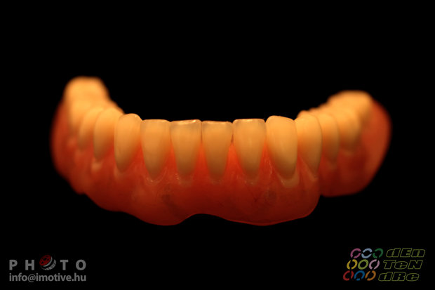 Upper and lower full dentures-4