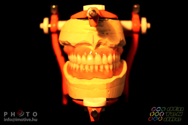 Upper and lower full dentures-5