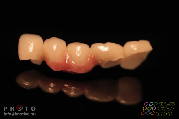 Made of zirconium.