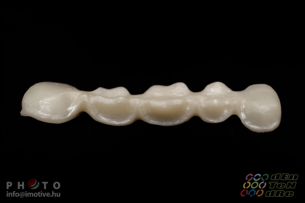 5 units zirconium frame with bracing, before covering.
