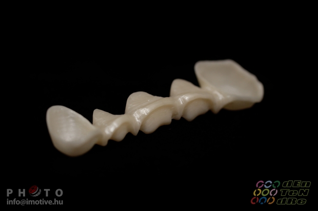 5 units zirconium frame with bracing, before covering.-2