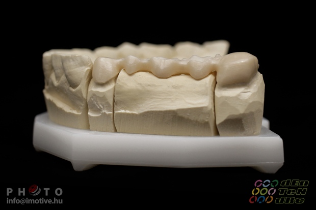 5 units zirconium frame with bracing, before covering.-3