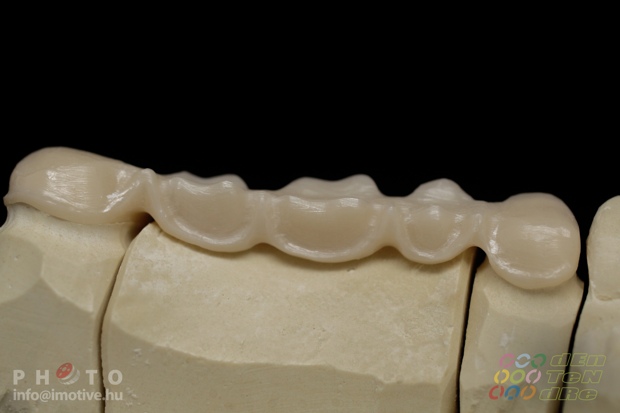5 units zirconium frame with bracing, before covering.-4