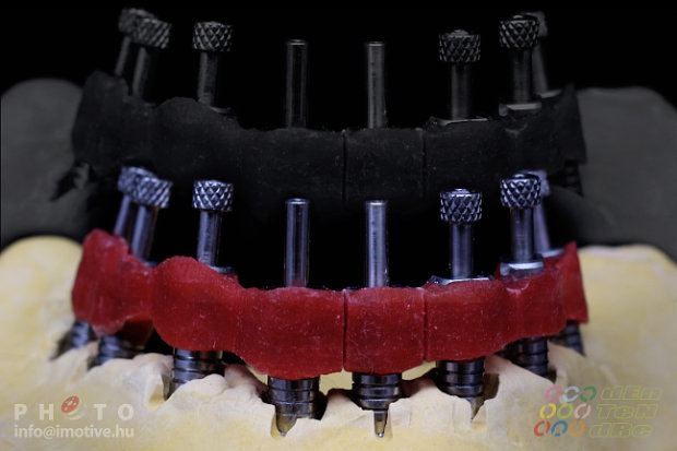 Special open tray for transfers in case of double impression taking for intraocclusal screw retain works.