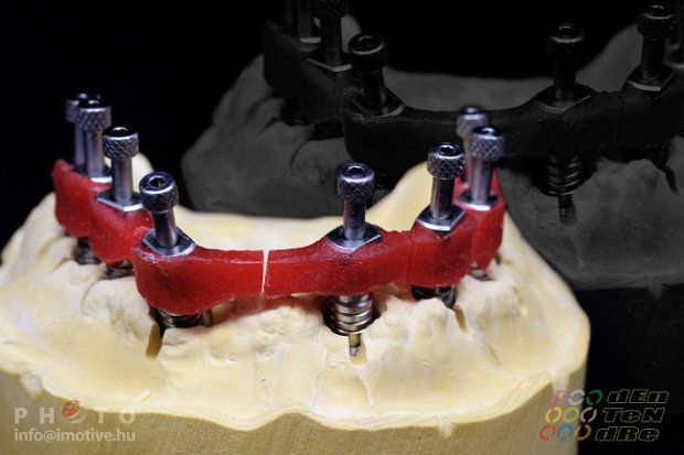 Special open tray for transfers in case of double impression taking for intraocclusal screw retain works.-2