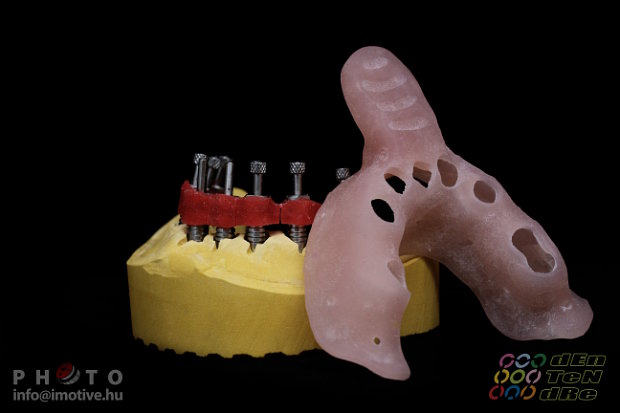 Special open tray for transfers in case of double impression taking for intraocclusal screw retain works.-3