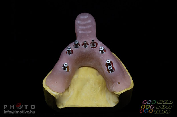 Special open tray for transfers in case of double impression taking for intraocclusal screw retain works.-4