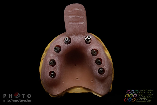 Special open tray for transfers in case of double impression taking for intraocclusal screw retain works.-5