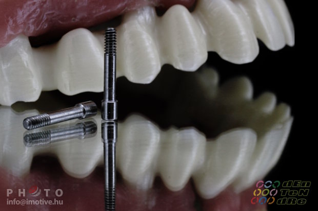 Upper screw retained long span bridge frame made of zirconium.-2