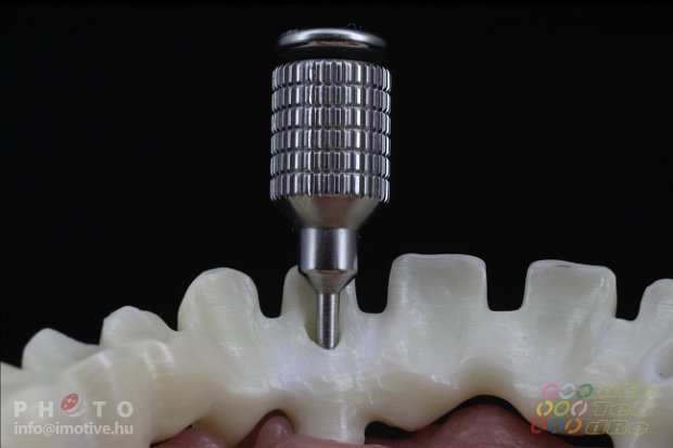 Upper screw retained long span bridge frame made of zirconium.-4